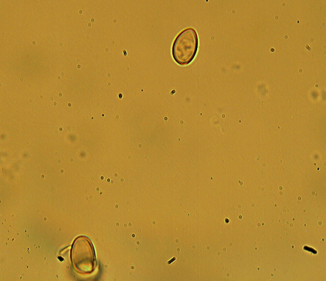 Messa a punto del microscopio